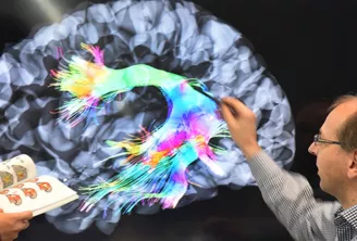 Un chercheur portant des lunettes pointant vers une visualisation cérébrale colorée affichée sur un écran, montrant les voies neurales et l'activité en plusieurs couleurs incluant le vert, bleu, rose et jaune, avec une image de scan médical visible en arr